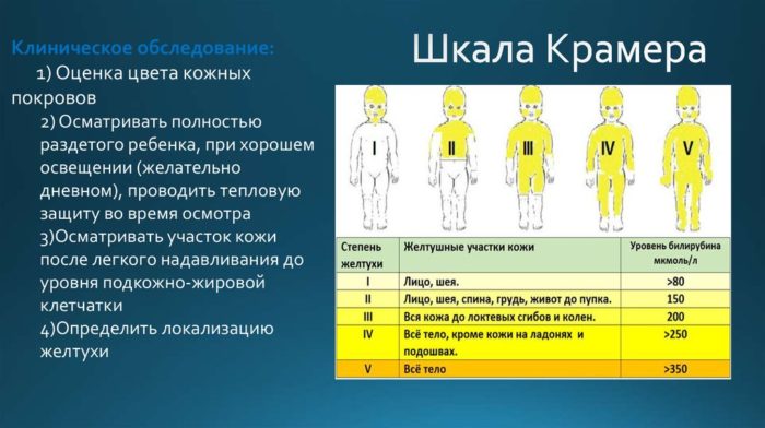 Описание и принцип на работа на лампата от жълтеница